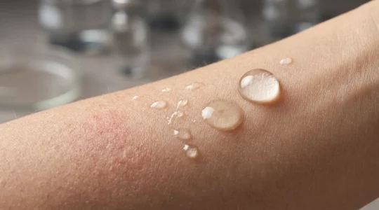 Hautanalyse von milden Kosmetikprodukten mit versteckten Reizauslösern